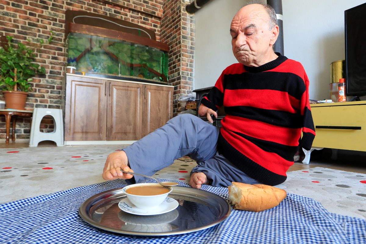 Engelleri Aşan Yaşam: Elleri Olmayan Mehmet Temel'in Ayaklarıyla Yürüttüğü Takı Dükkanı ve Hayat Mücadelesi