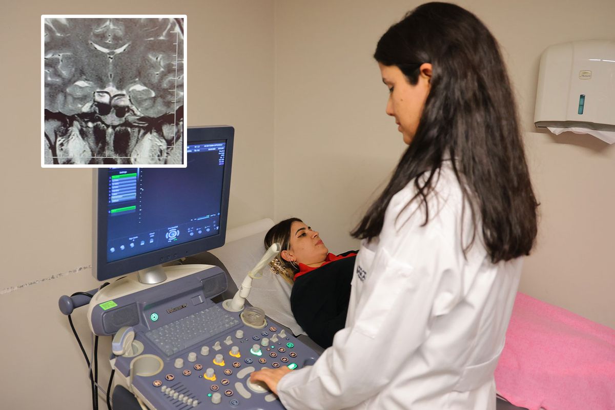 Gebelik Belirtileriyle Gelen Hasta Beyninde Prolaktinoma Tümörü Olduğu Anlaşıldı